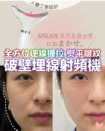 🇯🇵日本ANLAN新品🆕  「熨斗級」破壁深肌埋線射頻機